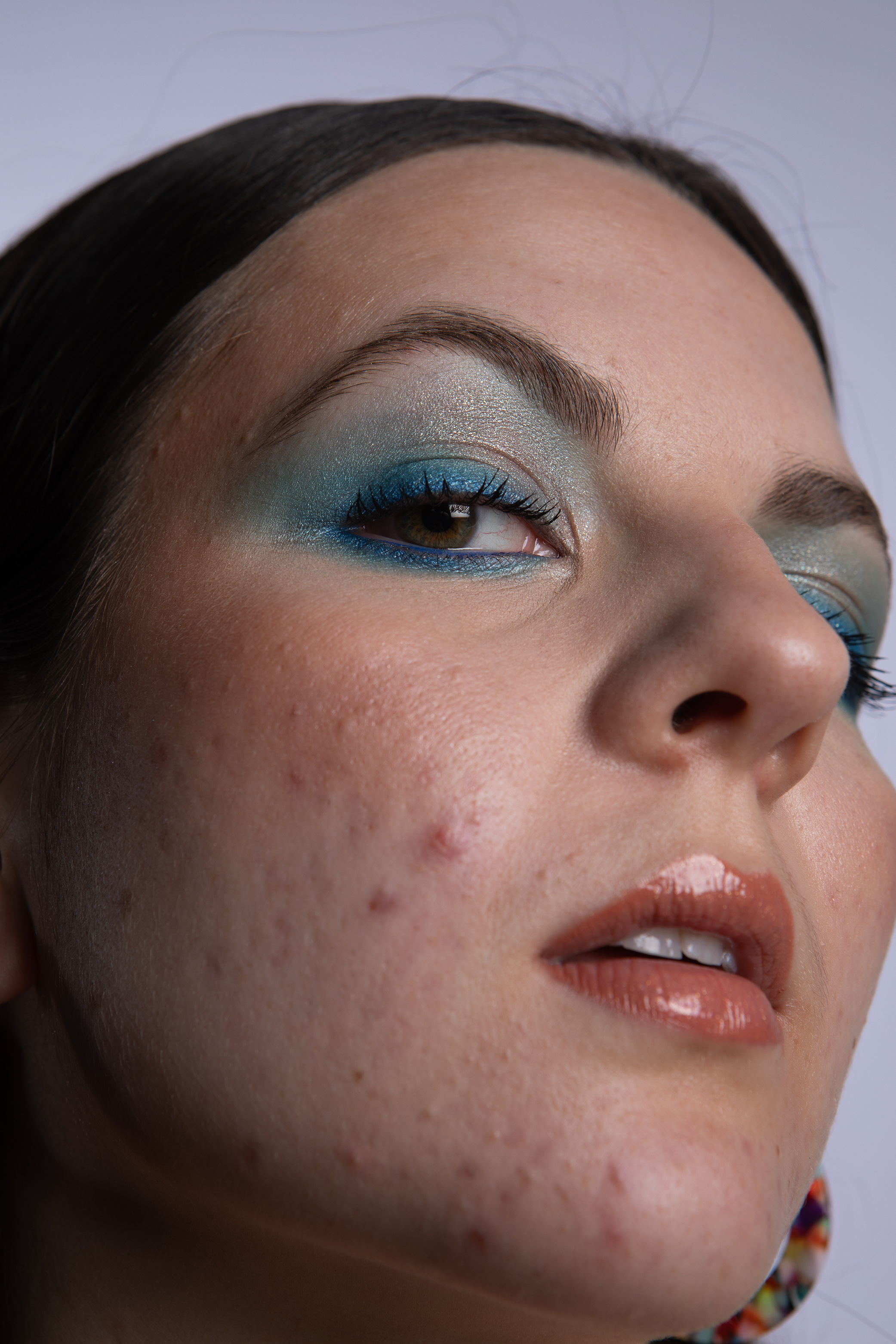 BA Photography work by Beth Unsworth showing an image of a brunette woman with acne.