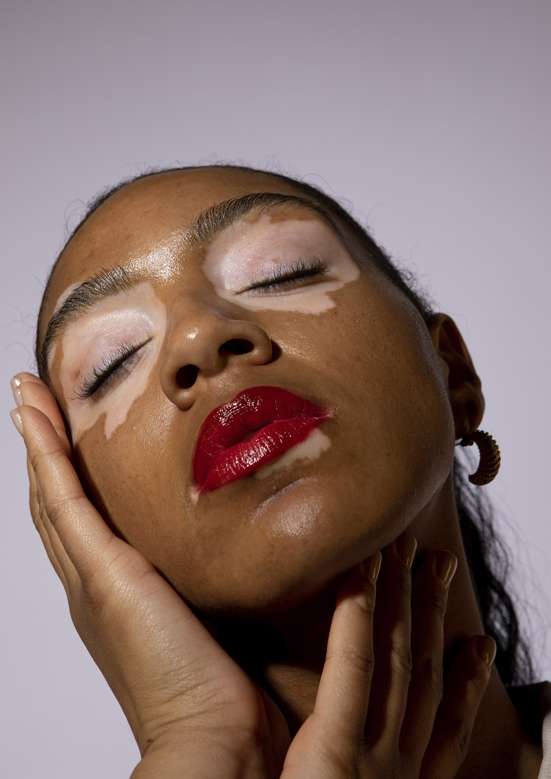 BA Photography work by Beth Unsworth showing a portrait of a woman with Vitiligo holding her face, wearing red lipstick.